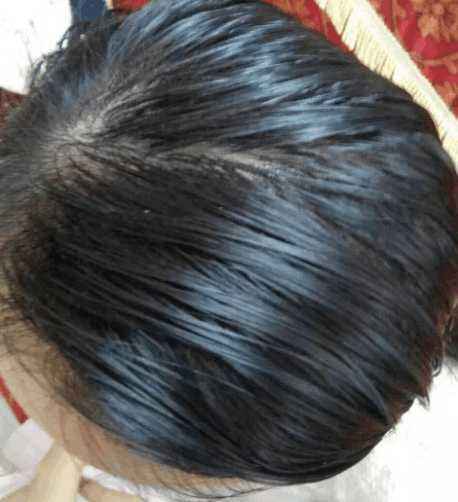 头发偏油该怎么办我们深圳按摩告诉你